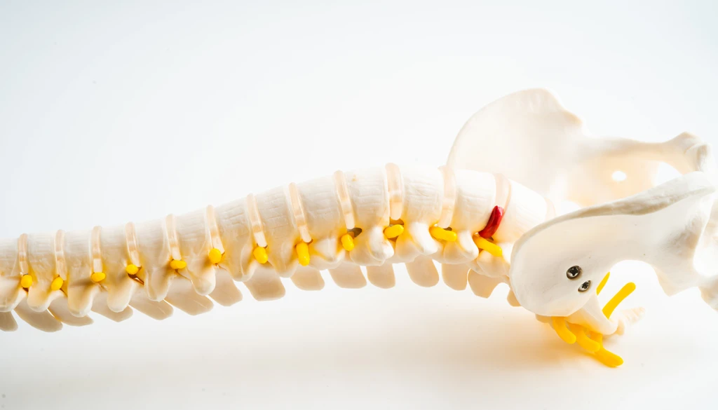 Névralgie, sciatique et cruralgie